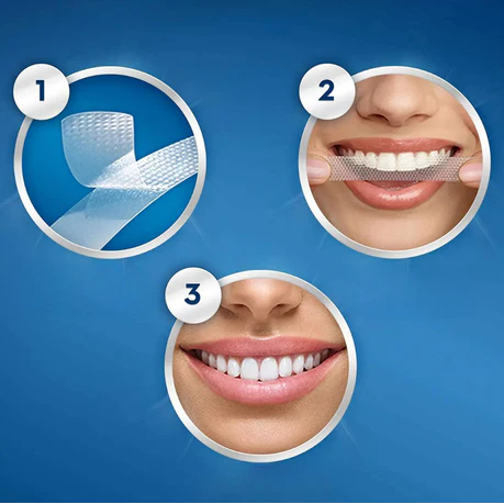 Crest 3D Whitestrips Luxe Professional Effects – 1 Sachet (1 Upper + 1 Lower Strip)